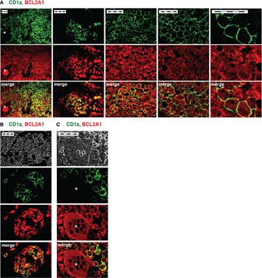 Neutralizing Anti-IL-17A Antibody Demonstrates Preclinical Activity Enhanced by Vinblastine in Langerhans Cell Histiocytosis